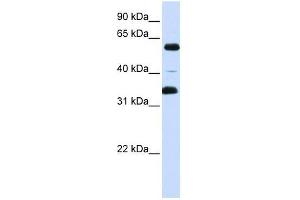 Western Blot showing ZKSCAN1 antibody used at a concentration of 1-2 ug/ml to detect its target protein. (ZKSCAN1 抗体  (Middle Region))