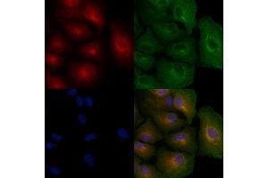 ABIN6256960 and ABIN6274918 staining  cells by IF/ICC. (BMP10 抗体  (Internal Region))