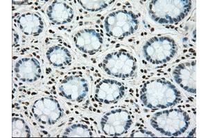 Image no. 2 for anti-TYRO3 Protein Tyrosine Kinase (TYRO3) antibody (ABIN1501608) (TYRO3 抗体)