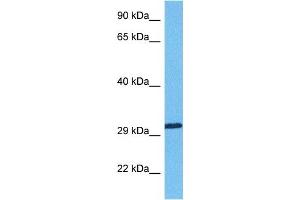 Host:  Rabbit  Target Name:  RBM7  Sample Tissue:  Human Lung Tumor  Antibody Dilution:  1ug/ml (RBM7 抗体  (Middle Region))