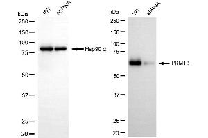 anti-Protein Arginine Methyltransferase 3 (PRMT3) antibody