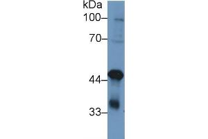 Detection of TDP43 in Human K562 cell lysate using Polyclonal Antibody to Tar DNA Binding Protein 43 kDa (TDP43) (TARDBP 抗体  (AA 104-262))