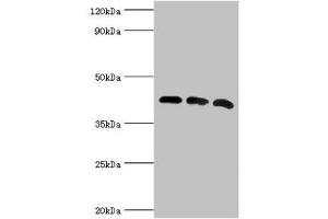 Western blot All lanes: Alpha-centractin antibody at 8 μg/mL Lane 1: Mouse brain tissue Lane 2: MCF-7 whole cell lysate Lane 3: Mouse liver tissue Secondary Goat polyclonal to rabbit IgG at 1/10000 dilution Predicted band size: 43 kDa Observed band size: 43 kDa (ACTR1A 抗体  (AA 187-376))