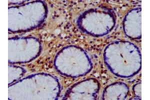 Immunohistochemistry (IHC) image for anti-Wingless-Type MMTV Integration Site Family, Member 8A (WNT8A) (AA 223-309) antibody (ABIN7166315)