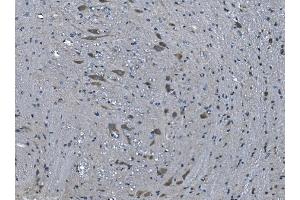 IHC analysis of TMPRSS3 using anti-TMPRSS3 antibody (ABIN7601198). (TMPRSS3 抗体  (AA 3-454))