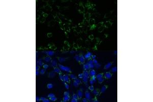 Immunofluorescence analysis of NIH-3T3 cells using GLUD1 antibody (ABIN6127975, ABIN6141157, ABIN6141158 and ABIN6223546) at dilution of 1:100. (GLUD1 抗体  (AA 54-240))