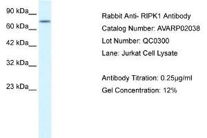 WB Suggested Anti-RIPK1  Antibody Titration: 0. (RIPK1 抗体  (Middle Region))