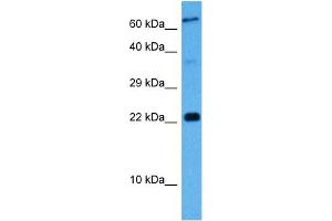 Host:  Mouse  Target Name:  MAFK  Sample Tissue:  Mouse Liver  Antibody Dilution:  1ug/ml (Mafg 抗体  (Middle Region))