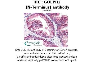Image no. 1 for anti-Golgi phosphoprotein 3 (Coat-Protein) (GOLPH3) (N-Term) antibody (ABIN1734859)