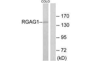 Western blot analysis of extracts from COLO cells, using RGAG1 antibody. (Retrotransposon Gag-Like Protein 9 (RTL9) (C-Term) 抗体)
