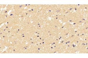 Immunohistochemistry (IHC) image for anti-Tubulin, beta (TUBB) (AA 170-419) antibody (ABIN7428434)