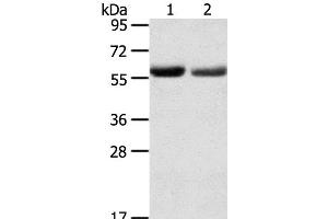 Western Blot analysis of Human normal stomach and stomach cancer tissue using SLC16A9 Polyclonal Antibody at dilution of 1:200 (SLC16A9 抗体)