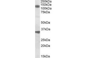 Western Blotting (WB) image for anti-Cell Division Cycle and Apoptosis Regulator 1 (CCAR1) (Internal Region) antibody (ABIN2464383) (CCAR1 抗体  (Internal Region))