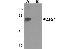 Western blot analysis of ZF21 in 3T3 cell tissue lysate with ZF21 antibody at 1 µg/mL in (A) the absence and (B) the presence of blocking peptide.