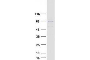 Validation with Western Blot