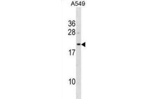 Western Blotting (WB) image for anti-Flavin Reductase (BLVRB) antibody (ABIN3001274) (BLVRB 抗体)
