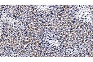 Immunohistochemistry (IHC) image for anti-Toll-Interleukin 1 Receptor (TIR) Domain Containing Adaptor Protein (TIRAP) (AA 1-221) antibody (ABIN7441712)