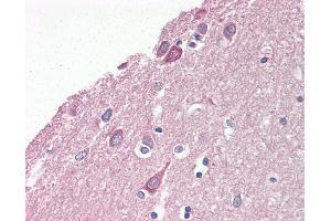 Immunohistochemistry (IHC) image for anti-Platelet-Activating Factor Acetylhydrolase 1b, Regulatory Subunit 1 (45kDa) (PAFAH1B1) (N-Term) antibody (ABIN6749762)
