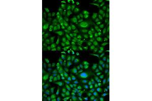 Immunofluorescence analysis of U2OS cell using HSPA1L antibody. (HSPA1L 抗体  (AA 342-641))