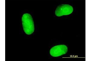 Immunofluorescence of purified MaxPab antibody to MAGEB1 on Hs 181. (MAGEB1 抗体  (AA 1-347))
