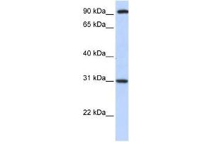 ANKRA2 antibody used at 0. (ANKRA2 抗体  (C-Term))