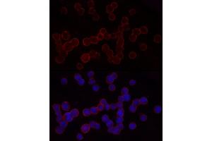 Immunofluorescence (IF) image for anti-Integrin beta 2 (ITGB2) (AA 70-170) antibody (ABIN3023118)