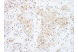 anti-Eyes Absent Homolog 2 (Drosophila) (EYA2) (AA 1-50) antibody