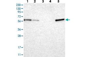 Western blot analysis of Lane 1: RT-4, Lane 2: U-251 MG, Lane 3: Human Plasma, Lane 4: Liver, Lane 5: Tonsil with TXNDC10 polyclonal antibody .