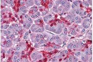 Human Pancreas: Formalin-Fixed, Paraffin-Embedded (FFPE) (HOXB7 抗体  (AA 55-121))