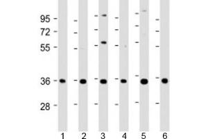 Western blot testing of human 1) A431, 2) HeLa, 3) HepG2, 4) Jurkat, 5) U-2OS and 6) SH-SY5Y cell lysate with NT5C3 antibody at 1:2000. (NT5C3 抗体  (AA 282-313))