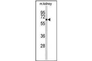 Western blot analysis of CYP27B1 Antibody (C-term)  in mouse kidney tissue lysates (35ug/lane). (CYP27B1 抗体  (C-Term))