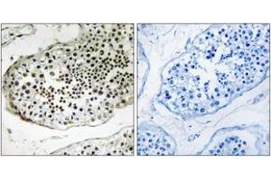 Immunohistochemistry analysis of paraffin-embedded human testis tissue, using UBQLN3 Antibody. (Ubiquilin 3 抗体  (AA 271-320))