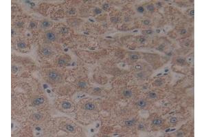 DAB staining on IHC-P; Samples: Human Liver Tissue (CYP26B1 抗体  (AA 1-512))