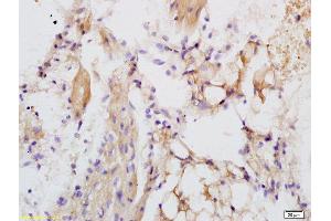 Formalin-fixed and paraffin embedded rat heart labeled with Anti-LRIG1 Polyclonal Antibody, Unconjugated (ABIN735263) at 1:200 followed by conjugation to the secondary antibody and DAB staining. (Lrig1 抗体  (AA 1001-1093))