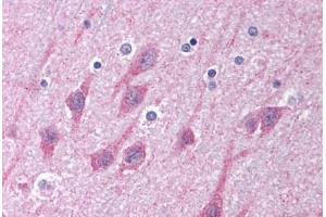 Human Brain, Cortex (formalin-fixed, paraffin-embedded) stained with TICAM1 antibody ABIN213993 at 5 ug/ml followed by biotinylated goat anti-rabbit IgG secondary antibody ABIN481713, alkaline phosphatase-streptavidin and chromogen. (TICAM1 抗体  (C-Term))