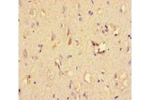Immunohistochemistry of paraffin-embedded human brain tissue using ABIN7169664 at dilution of 1:100 (STAT1 抗体  (AA 63-196))
