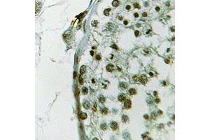 Immunohistochemical analysis of Ubiquilin 3 staining in human testis formalin fixed paraffin embedded tissue section. (Ubiquilin 3 抗体  (Center))