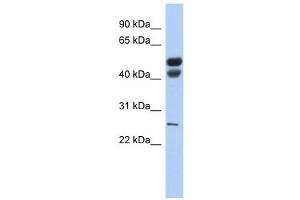 Lipase antibody (Gastric) used at 1 ug/ml to detect target protein. (LIPF 抗体  (N-Term))