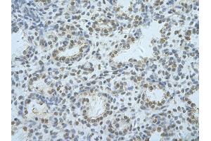 Rabbit Anti-HNRNPF Antibody       Paraffin Embedded Tissue:  Human alveolar cell   Cellular Data:  Epithelial cells of renal tubule  Antibody Concentration:   4. (HNRNPF 抗体  (C-Term))