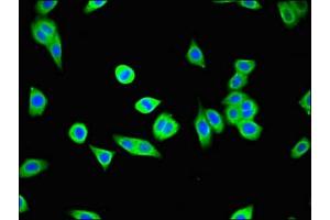 Immunofluorescent analysis of HepG2 cells using ABIN7174296 at dilution of 1:100 and Alexa Fluor 488-congugated AffiniPure Goat Anti-Rabbit IgG(H+L) (USP25 抗体  (C-Term))