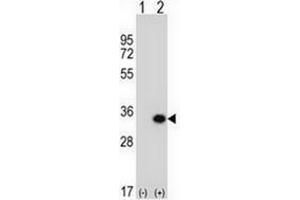 Western blot analysis of GCLM (arrow) using GCLM / GLCLR Antibody (C-term) Cat. (GCLM 抗体  (C-Term))