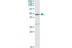 Immunoprecipitation of CPA1 transfected lysate using anti-CPA1 monoclonal antibody and Protein A Magnetic Bead , and immunoblotted with CPA1 MaxPab rabbit polyclonal antibody. (CPA1 抗体  (AA 1-419))