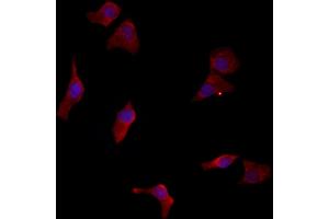 ABIN6262952 and ABIN6277129 staining HepG2 by IF/ICC. (LETMD1 抗体  (N-Term))