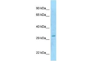 WB Suggested Anti-SAP30BP Antibody Titration: 1. (SAP30BP 抗体  (N-Term))