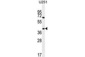 Western blot analysis in U251 cell line lysates (35ug/lane) using Proline-rich protein 16 / PRR16 Antibody (C-term). (PRR16 抗体  (C-Term))