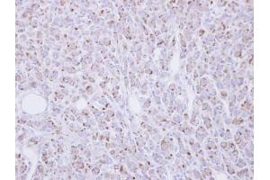 IHC-P Image Immunohistochemical analysis of paraffin-embedded U87 xenograft, using RGMB, antibody at 1:100 dilution. (RGMB 抗体  (Center))