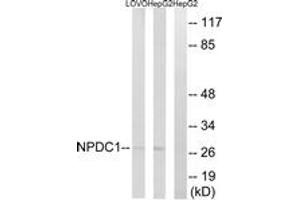 Western blot analysis of extracts from HepG2/LOVO cells, using NPDC1 Antibody. (NPDC1 抗体  (AA 189-238))