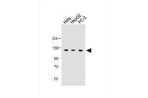 All lanes : Anti-C15orf2 Antibody (Center) at 1:1000 dilution Lane 1: Hela whole cell lysate Lane 2: HepG2 whole cell lysate Lane 3: PC-3 whole cell lysate Lysates/proteins at 20 μg per lane. (NPAP1 抗体  (AA 348-377))