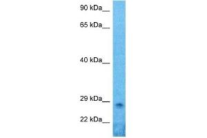 Host:  Rabbit  Target Name:  PRRX1  Sample Type:  Hela Whole Cell lysates  Antibody Dilution:  1. (PRRX1 抗体  (N-Term))