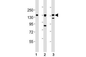 AXL antibody at 1:2000 dilution.